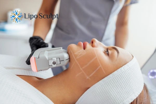 HIFU vs Botulinum Toxin: Understanding the Differences 1 HIFU vs Botox Almondsbury What is the best option for you?