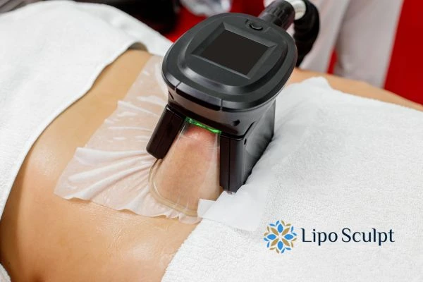 Does Fat Freezing at Home Work? DIY Devices vs Professional Cryolipolysis 1 How is professional cryolipolysis different Almondsbury?