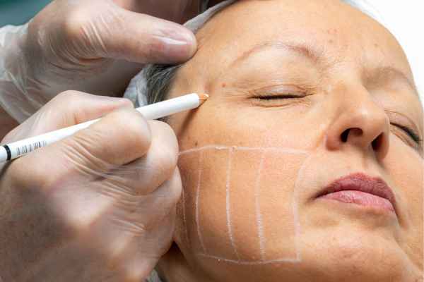 CryoPen: 5 Skin Concerns It May Be Used to Treat 4 What should you ask before having CryoPen treatment Almondsbury?