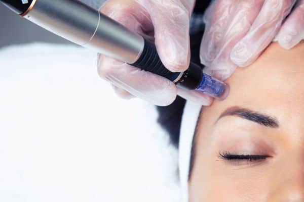Explaining Total Skin Tightening Treatment and What to Expect 2 What Skin Concerns Can Total Skin Tightening Treatment Help With Almondsbury?